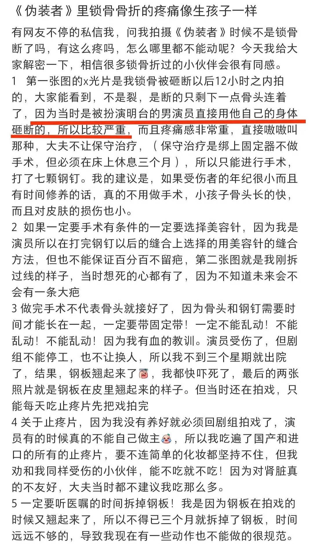 《伪装者》演员王乐君称曾被胡歌砸断锁骨